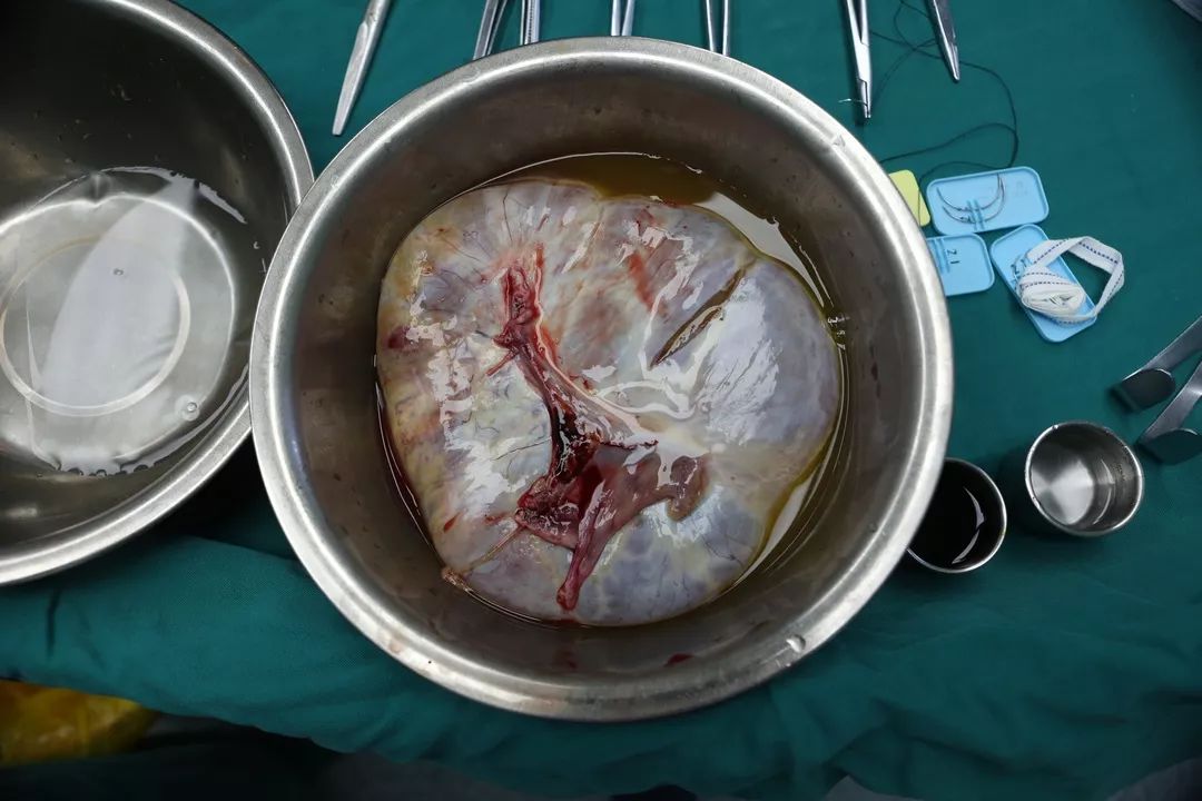 ny11_763552.jpg e5.jpg