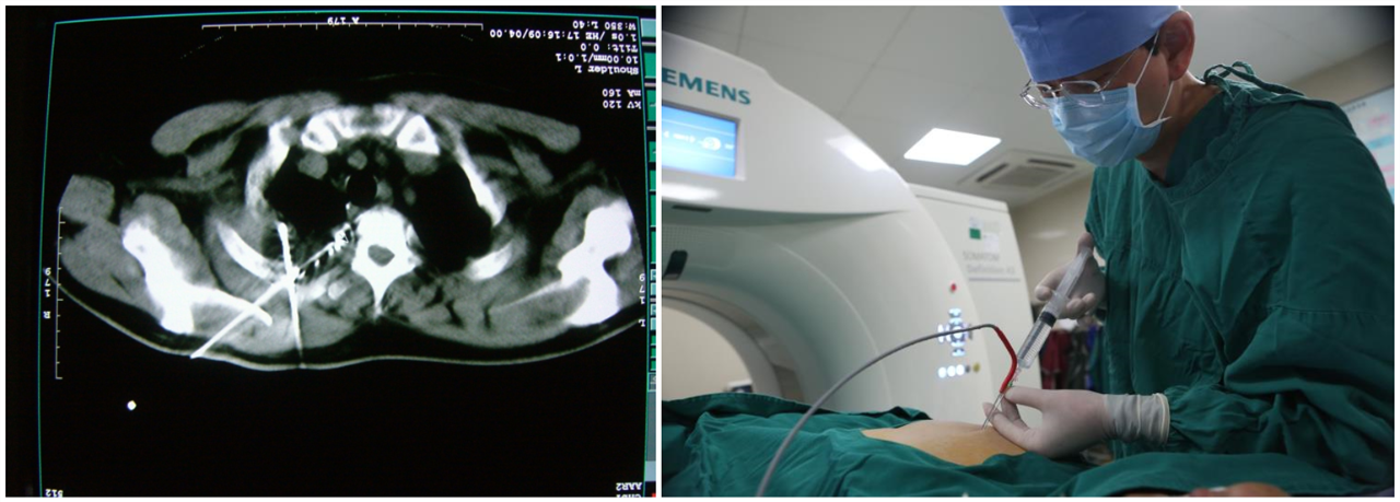 ny14_266964.png ny14_266964.png