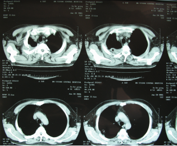 ny14_764895.png c114.png