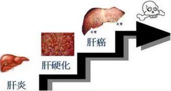 ny28_437123.jpg h23.jpg