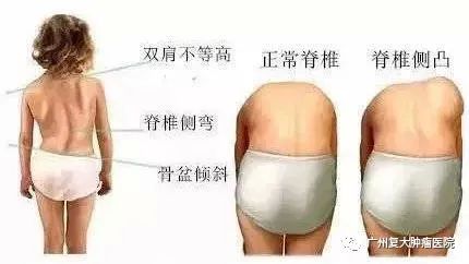 ny17_525932.jpg s3.jpg