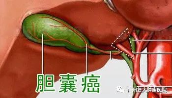 ny07_541362.jpg t3.jpg