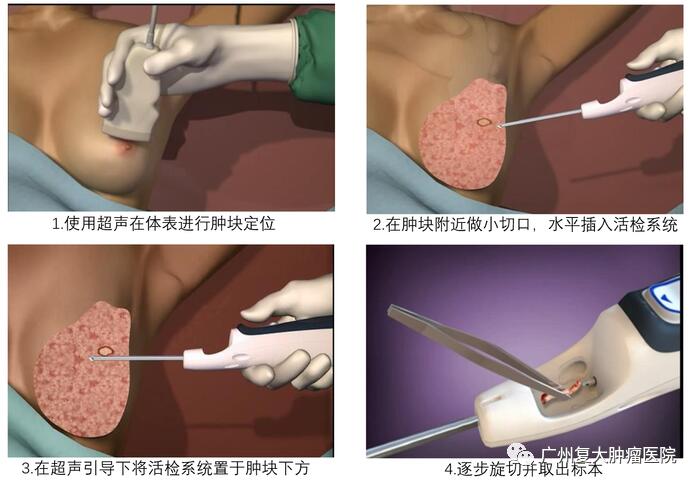 ny18_603420.jpg 1240.jpg