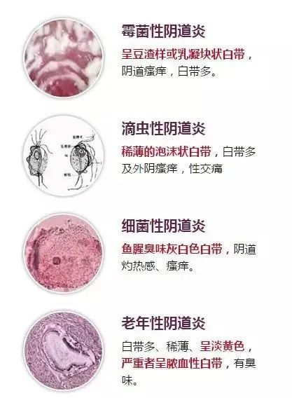 ny18_852551.png kk1.png